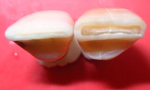 esmalte de las piezas dentales